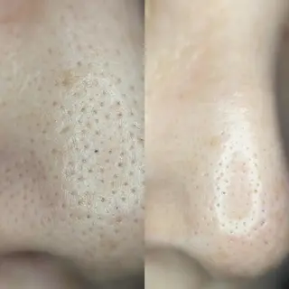  毛穴洗浄・まつ毛 の専門店 ソラーレのエステ・リラクイメージ