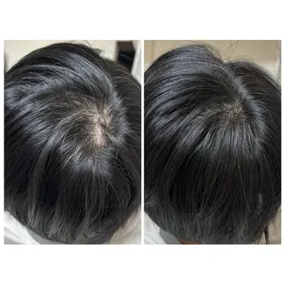 メンズ 肌質改善Charme coco  増毛のエステ・リラクイメージ