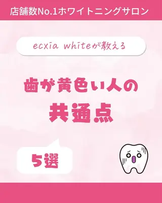 セルフホワイトニング エクシア大曽根店のその他イメージ