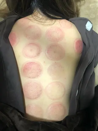 やはた鍼灸整骨院所属・やはた 鍼灸整骨院のエステ・リラクイメージ