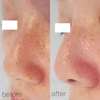 CLEAD赤坂見附店 坂田のエステ・リラクイメージ