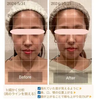 小顔×肌質改善サロン soin〔ソワン〕のエステ・リラクイメージ