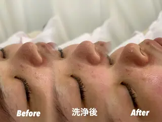 🫧美しい素肌へ🫧 今成柚乃のその他イメージ