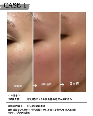 素肌育成・シミケア専門サロン美潤-miulu-所属・【医療提携サロン】 【シミケア専門】のエステ・リラクイメージ