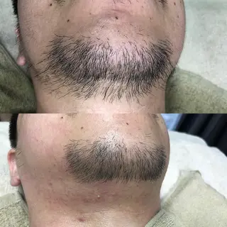 メンズ BRUSH  BODY所属・男性施術者による 光脱毛×ワックス脱毛のエステ・リラクイメージ