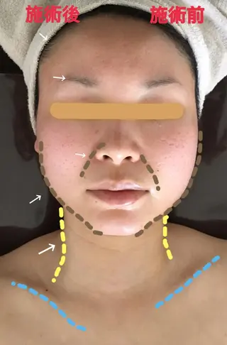 美筋骨格リンパ®️ Aroleのエステ・リラクイメージ