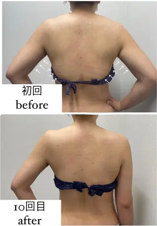 ENCHANT 脱毛.小顔.毛穴のエステ・リラクイメージ