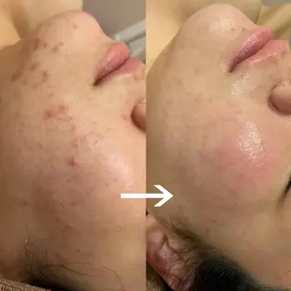 MELIA the beauty所属・肌のお悩み改善サロン MELIA/朋美のエステ・リラクイメージ