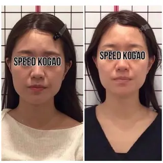 小顔矯正Speed KOGAO渋谷本店のエステ・リラクイメージ