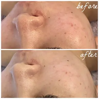 メンズ メナード岐阜市茜部 杉浦のエステ・リラクイメージ