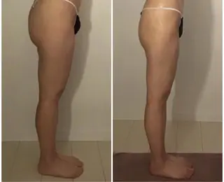 BELLEFINE 💕痩身・小顔・脱毛のエステ・リラクイメージ