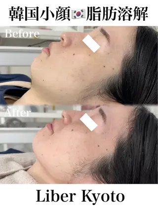 Liber【リベル】 AYAKAのエステ・リラクイメージ