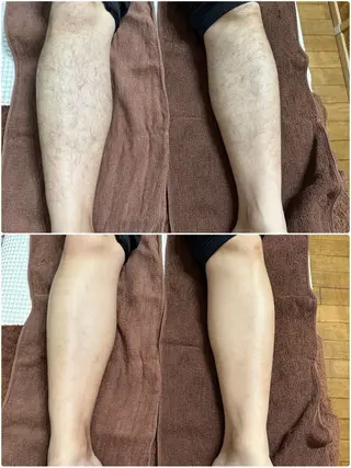 ホワイトニングジム 池袋のその他イメージ