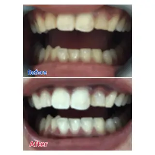 MBEAUTYSALON 千葉店・京成大久保所属・Melty 輝のその他イメージ