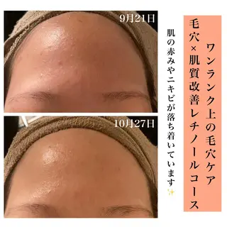 Bellesthe （ベルエステ）のエステ・リラクイメージ