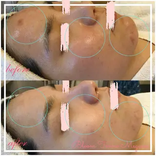 BLOOM〜 天恵（てんのめぐみ）のエステ・リラクイメージ