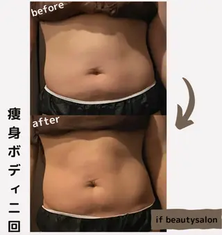 痩身・フェイシャル/if  byOrabriller所属・if byOrab riller【ｲﾌ】のその他イメージ