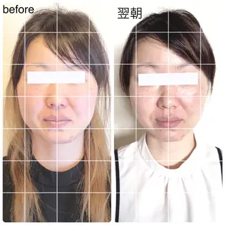 小顔矯正ドライヘッド Arincoのエステ・リラクイメージ