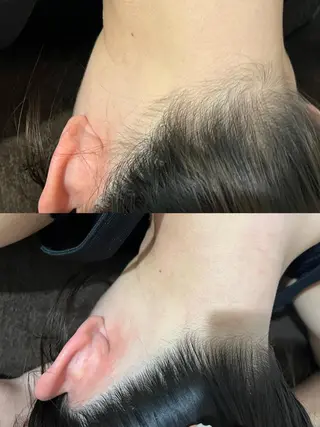 Reine BeautySalon所属・毛穴/シミ肝斑/脱毛 横山梨里のエステ・リラクイメージ