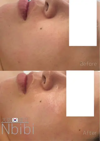 韓国🇰🇷価格 サロン_Nbibiのエステ・リラクイメージ