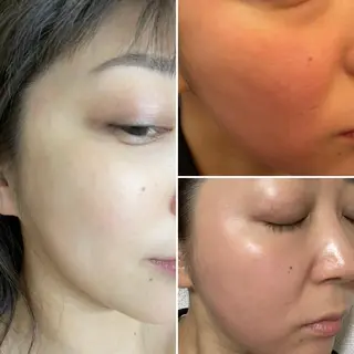 アロマ•ピーリング SalonYokoのその他イメージ