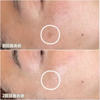 シミ・毛穴ケア専門 Lunaのエステ・リラクイメージ