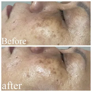 肌質改善サロン facialmoonのエステ・リラクイメージ