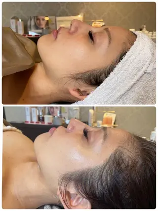 Belle beauty salon所属・Bellebeau tysalonのエステ・リラクイメージ