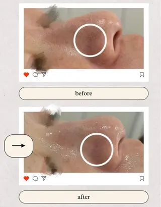 AY'S所属・倉敷/玉島/毛穴洗浄 古川碧のエステ・リラクイメージ