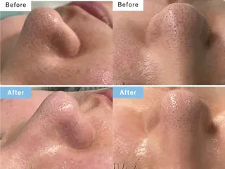 Laule'a ラウレアのエステ・リラクイメージ