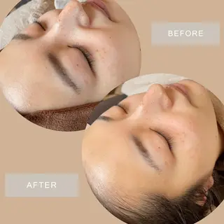 NATURA所属・シェービングサロン NATURAのエステ・リラクイメージ