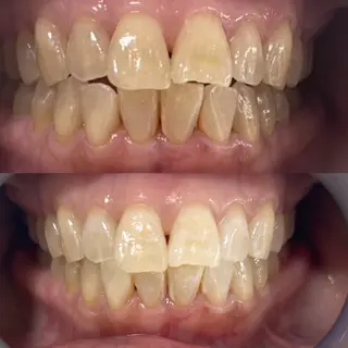 マツエク・マツパ ストーリー所属・セルフホワイトニング 耳ツボジュエリーのエステ・リラクイメージ