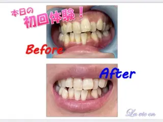 セルフホワイトニングサロン　ラヴィアン所属・ホワイトニングサロン La vie enのその他イメージ