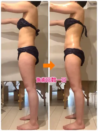 ロング カラー パーマ ヘアアレンジ メンズ キッズ ネイル マツエク・マツパ ‍痩身＆ボディ 結果出し🌟丹野のエステ・リラクイメージ