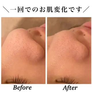 Bellesthe （ベルエステ）のエステ・リラクイメージ