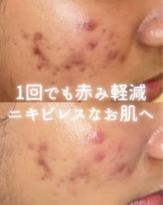 private beauty salon Lilby所属・リルビー 肌育・肌質改善サロンのその他イメージ