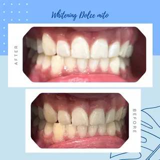 セルフホワイトニング Dolce水戸店のその他イメージ