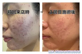 LEA MUSASHIKOSUGI所属・美肌育成サロン LEA武蔵小杉のエステ・リラクイメージ