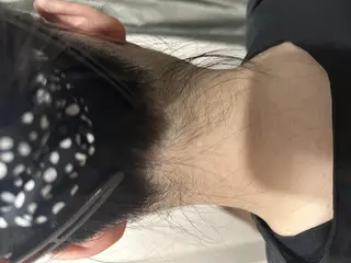 男女同額脱毛エステ salonLEPIAのエステ・リラクイメージ