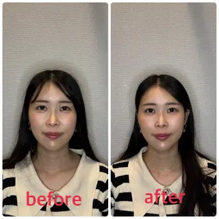 小林整骨院本町 美容鍼roomのエステ・リラクイメージ