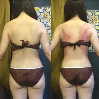 小顔やたるみに特化 💚野瀬可蓮のその他イメージ