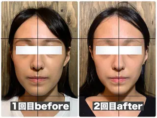 💎後悔させない小顔 矯正💎イトヤマ🌱のエステ・リラクイメージ