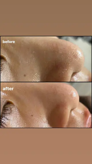 Y NAIL —BEAUTY SALON—所属・Y NAILのエステ・リラクイメージ