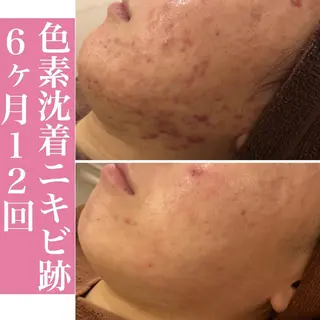 ミディアム カラー パーマ ヘアアレンジ メンズ キッズ ネイル マツエク・マツパ アイブロウ ニキビ・肌質改善専門 ♡人生が変わるサロンのエステ・リラクイメージ