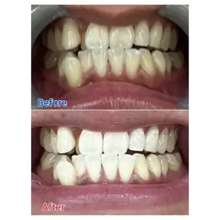 M渋谷店所属・M渋谷 ホワイトニングのエステ・リラクイメージ