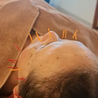 鍼灸サロンmiyabi所属・美容鍼×エステ　鍼灸 サロンmiyabiのエステ・リラクイメージ