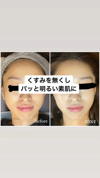 919private salon所属・919 AMIのエステ・リラクイメージ