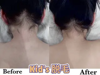 キッズ 脱毛＆水素 Salon Lovele所属・脱毛＆水素Salon Loveleのエステ・リラクイメージ