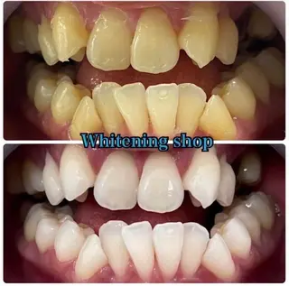 メンズ ホワイトニング ショップ船橋２号店のエステ・リラクイメージ