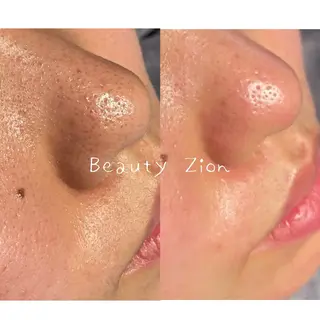 Beauty Zion所属・Beauty Zionのエステ・リラクイメージ
